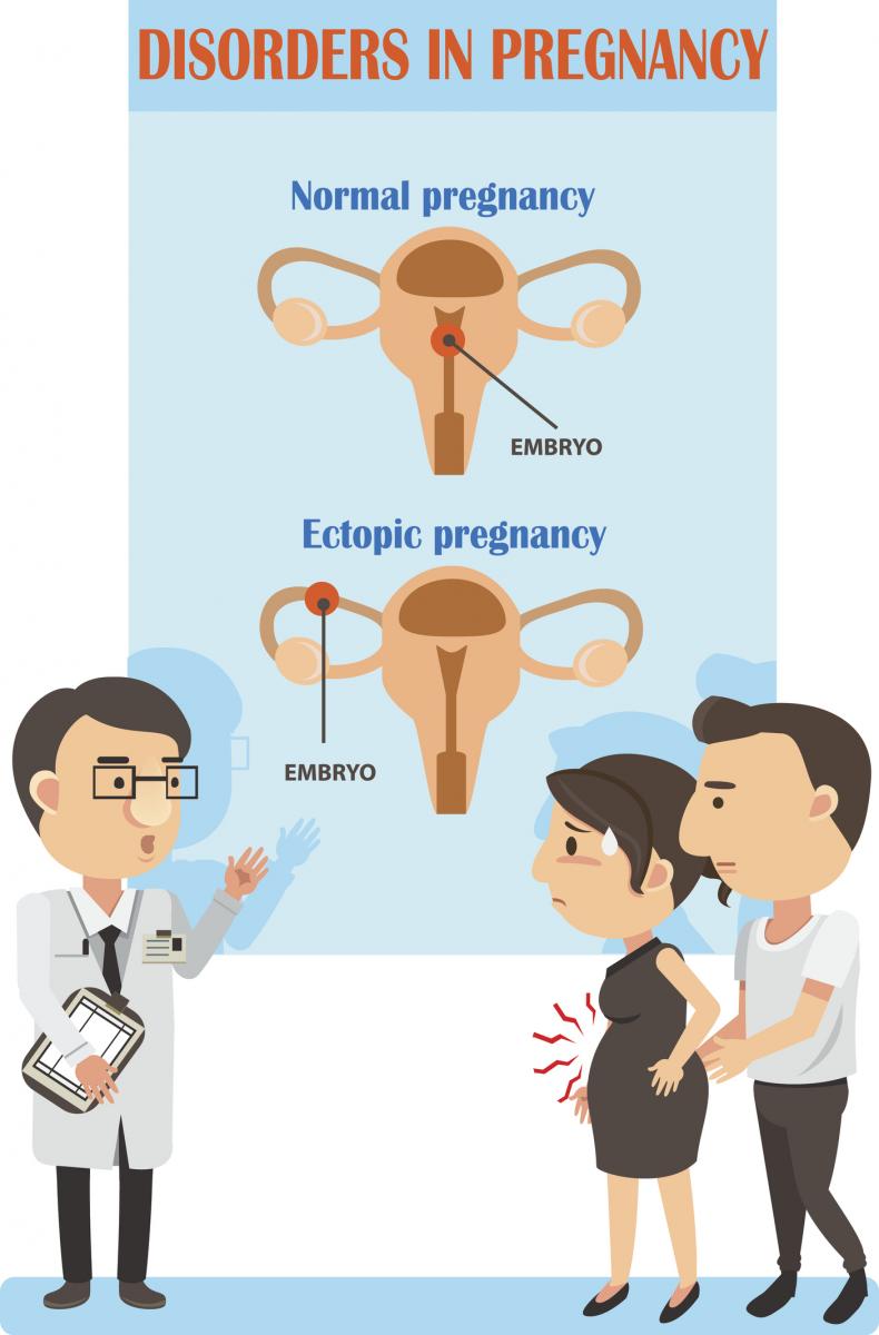 Ectopic Pregnancy Is A Medical Emergency Vukuzenzele 